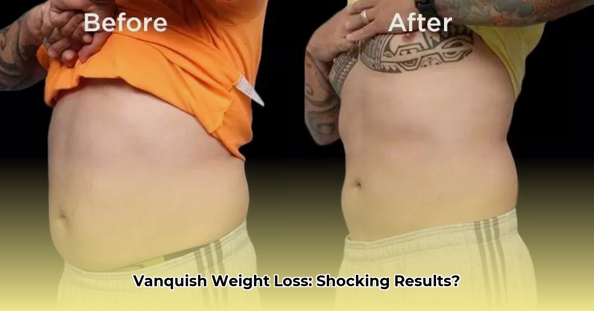 vanquish-weight-loss